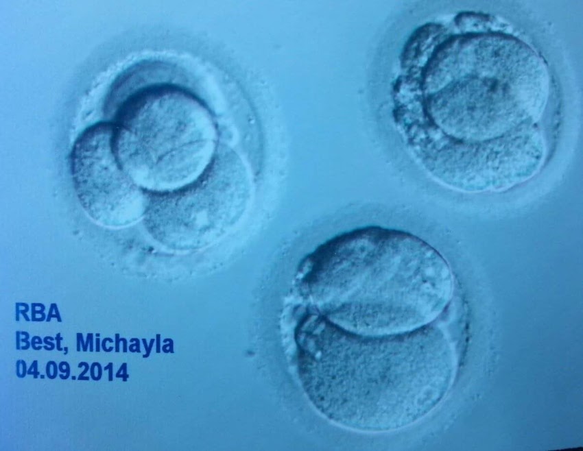 cytoblasts - treatments for fertility